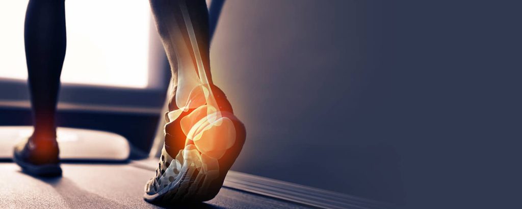 Why People Choose Atlas Biomechanics Foot Pads Orthotics A Complete Guide To Better Foot Health And Pain Relief 1